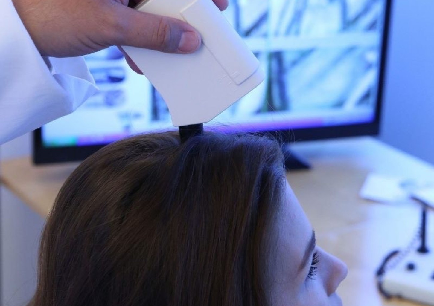 Galvos odos ir plauko būklės tyrimas „TricoTest“