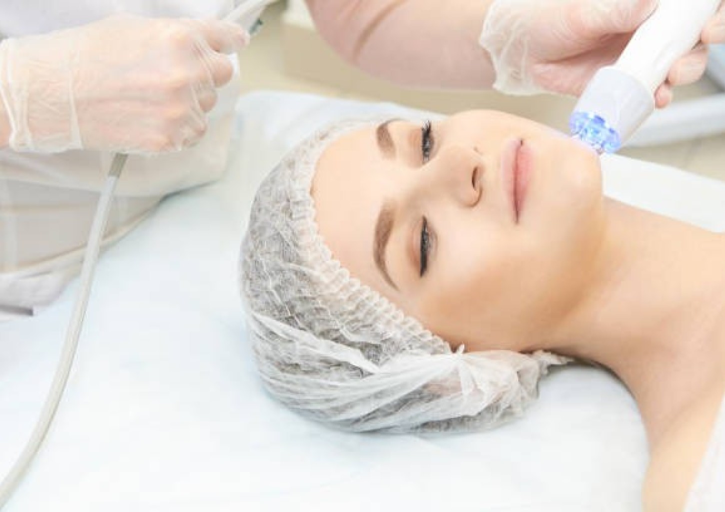 Radio dažnių terapija veidui, kaklui ir dekoltė