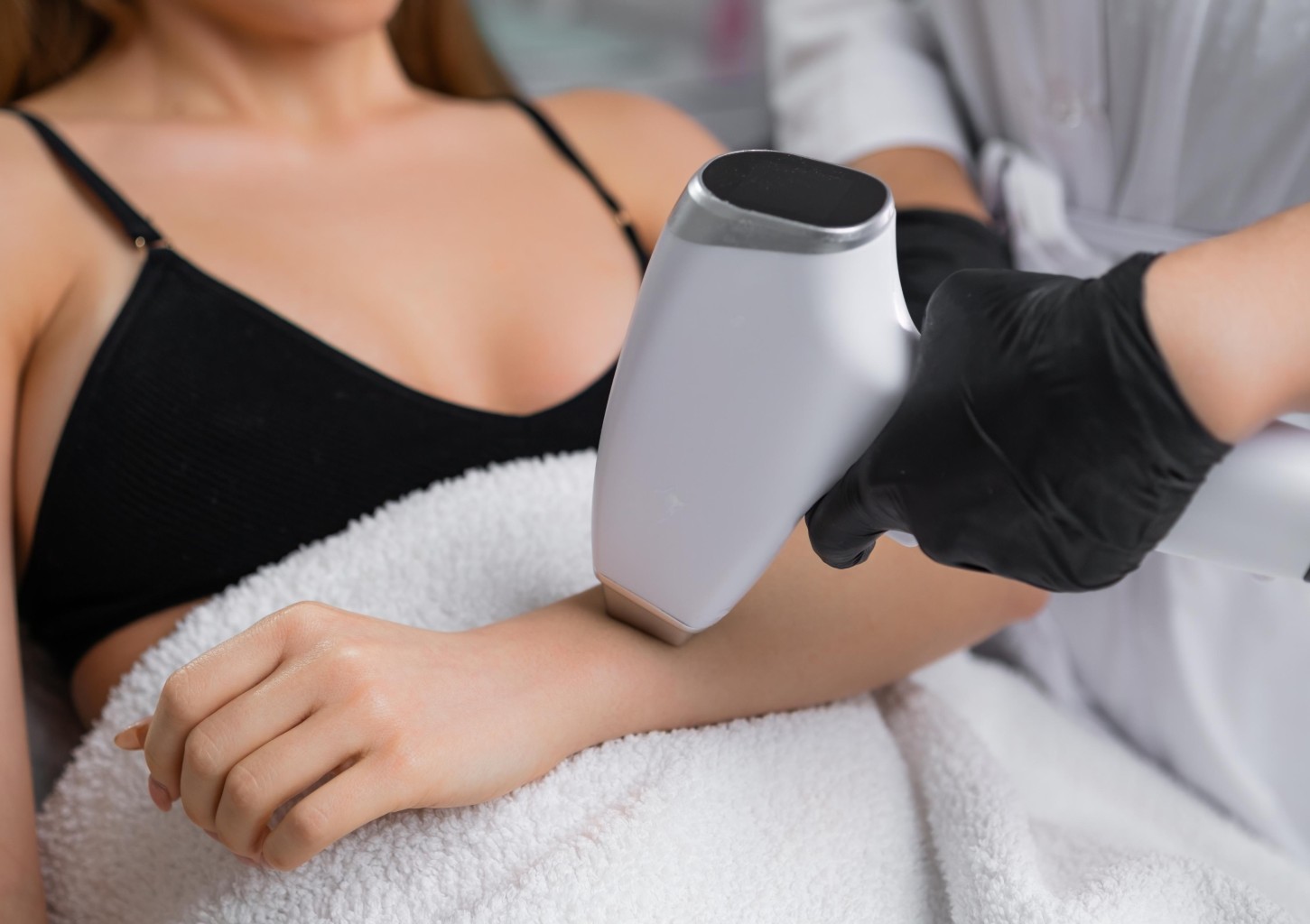 Plaukų šalinimas diodiniu lazeriu studijoje „MES - Modern Esthetic Solution“