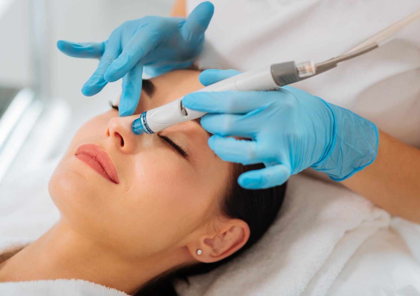 „HydraFacial“ - 4 etapų procedūra