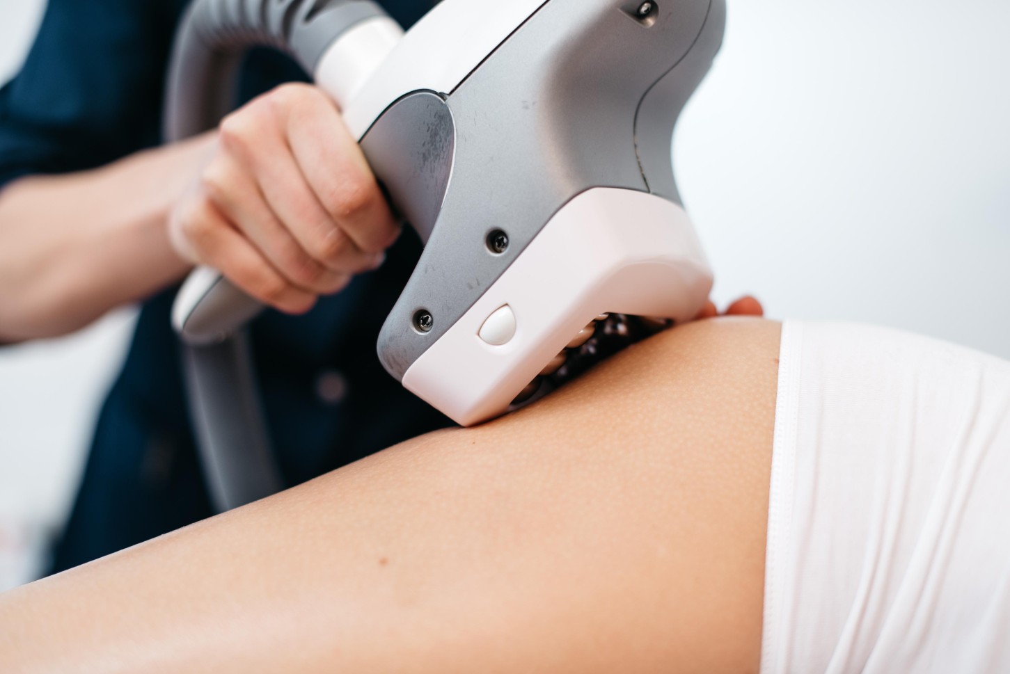 „VelaShape“ procedūra kojoms, sėdmenims ir pilvui